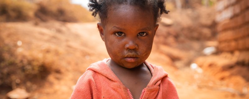 Armes kleines Mädchen in dreckiger Kleidung in einem afrikanischen Dorf, Armuts- und Krisenkonzept.